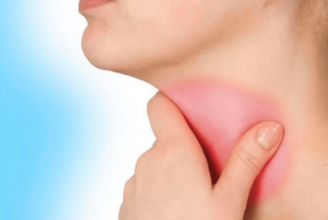 Αμυγδαλές και πάχος