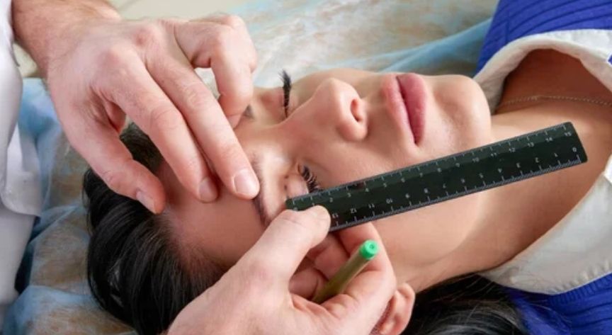 Βλεφαροπλαστική