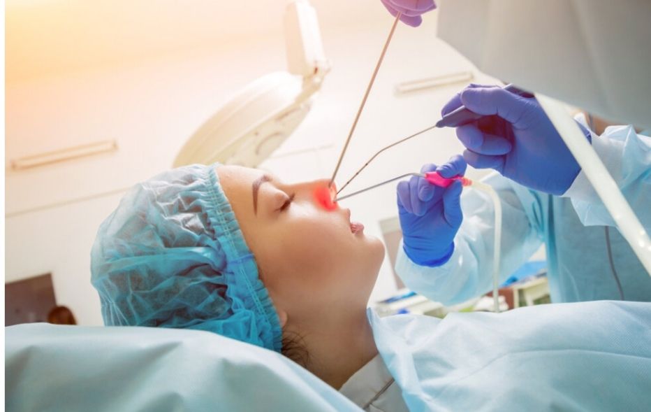 Κογχοπλαστική