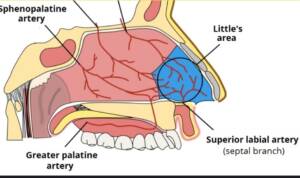 Ρινορραγία