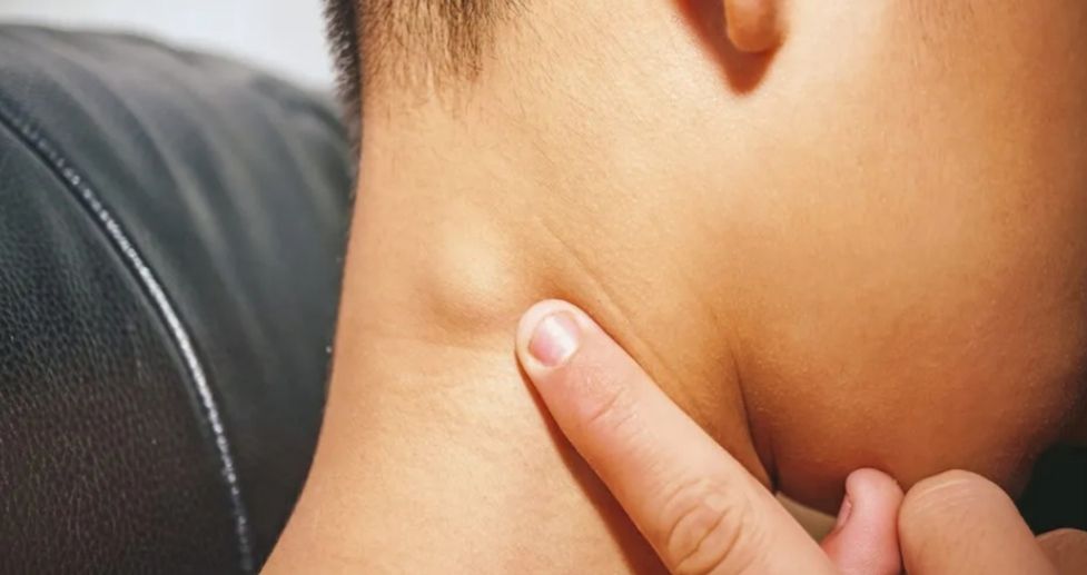 Καρκίνος Κεφαλής & Τραχήλου