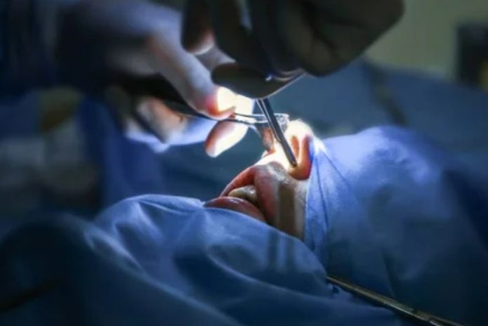 Ρινικές Κόγχες - Υπερτροφία